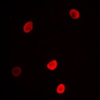 L3MBTL3 antibody