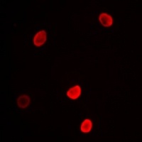 Anti-L3MBTL3 Antibody