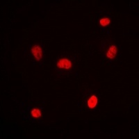Anti-RNF8 Antibody