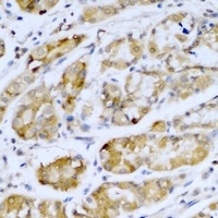 Anti-SETD5 Antibody