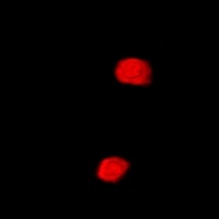 Anti-SETD5 Antibody