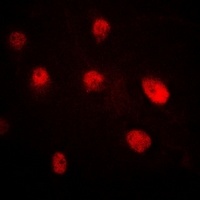 SETD8 antibody
