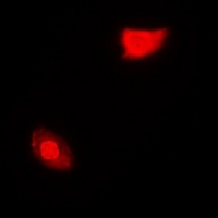 Anti-SGTA Antibody
