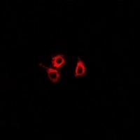 Anti-SMYD4 Antibody