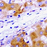 Anti-UBE2J2 Antibody