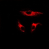 Anti-UBE2J2 Antibody