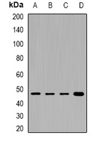 PHKG2 Rabbit Polyclonal Antibody