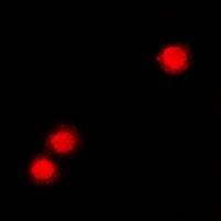 ZNF195 antibody