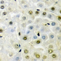 Anti-PRDM5 Antibody