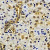 NAA50 antibody