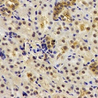 Anti-Deltex-2 Antibody