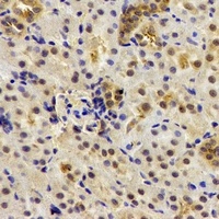 DTX2 antibody