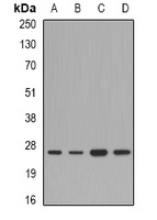 FAM173B Rabbit Polyclonal Antibody