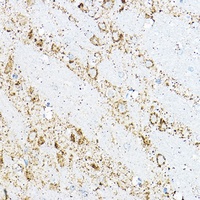 Anti-BCAT2 Antibody