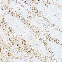 BCAT2 antibody