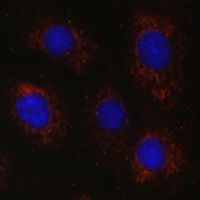 BCAT2 antibody