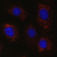 Anti-BCAT2 Antibody