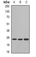 GSTM4 Antibody