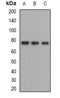 ZBTB48 Rabbit Polyclonal Antibody
