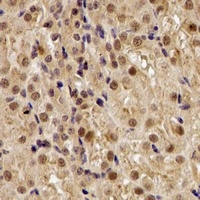 Anti-TUG Antibody