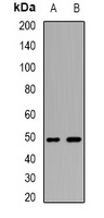 WIPI2 Rabbit Polyclonal Antibody