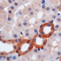 Anti-WIPI2 Antibody