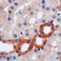 WIPI2 antibody