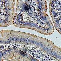 GLUD1 antibody