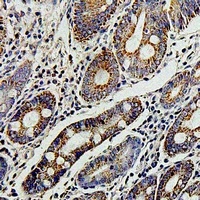 UBIAD1 antibody