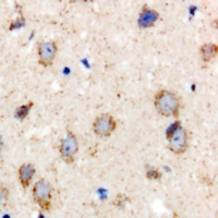 Anti-BCS1L Antibody