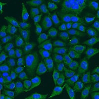 Anti-BCS1L Antibody