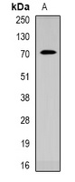 CACNB1 Rabbit Polyclonal Antibody