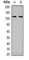 DDX11 Rabbit Polyclonal Antibody