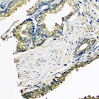 Anti-ETFA Antibody