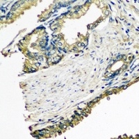 ETFA antibody