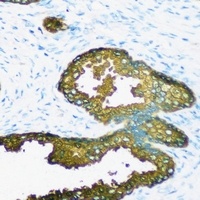 Anti-GSTA2 Antibody