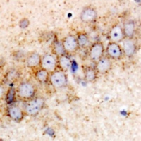 Anti-HSPA6 Antibody