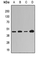LOX Rabbit Polyclonal Antibody