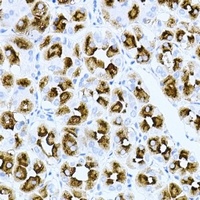 RAC1 antibody