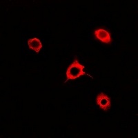 Anti-Rac 1 Antibody