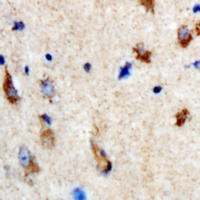 Anti-SHMT1 Antibody