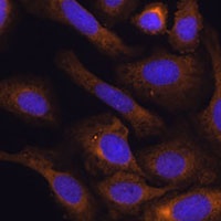 Anti-SHMT1 Antibody