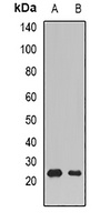 SSX5 Rabbit Polyclonal Antibody