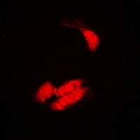 Anti-SULT2B1 Antibody