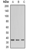 Barttin Rabbit Polyclonal Antibody