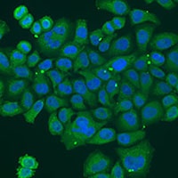 Anti-DPM1 Antibody
