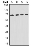 p62 Rabbit Polyclonal Antibody