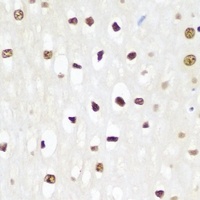 p62 Rabbit Polyclonal Antibody