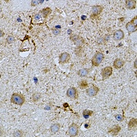 Anti-NAT8 Antibody