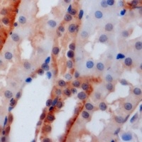 Anti-PSTPIP1 Antibody